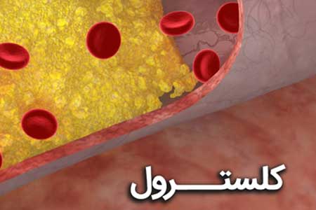 عکس خبري - راه هايي که سطح کلسترول بد را پايين مي آورد