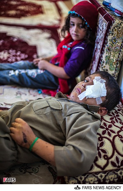 عکس خبري -يکي از کودکان مجروح شده در حادثه انفجار مين درمريوان 